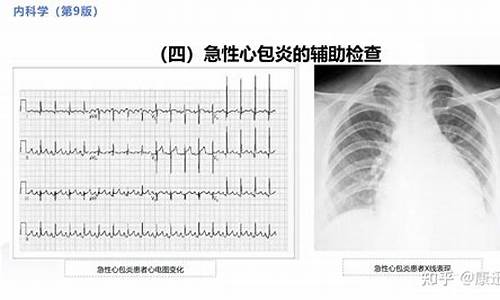 心包结核诊断方法有哪几种类型_心包结核诊