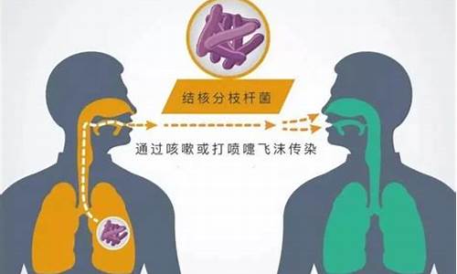 心包结核会传染吗如何处理好_心包结核的症状能治好吗